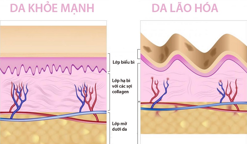 Thiếu hụt Collagen có ảnh hưởng xấu đến da